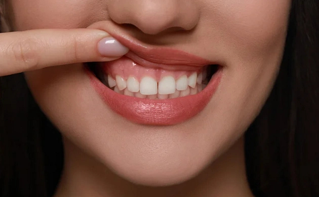 Woman receiving smile gum treatment at dental office