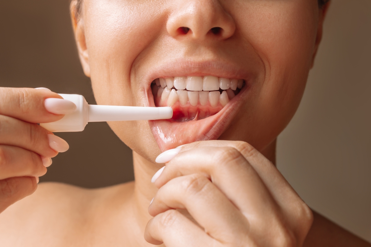 periodontal disease treatment in Burbank