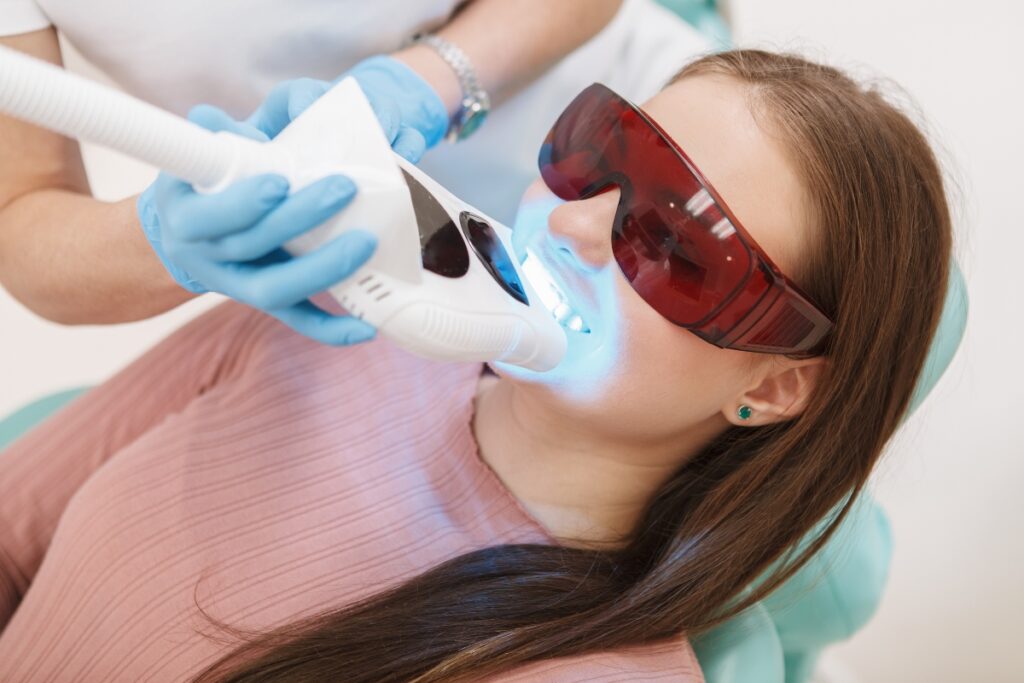 teeth-whitening-in-Burbank