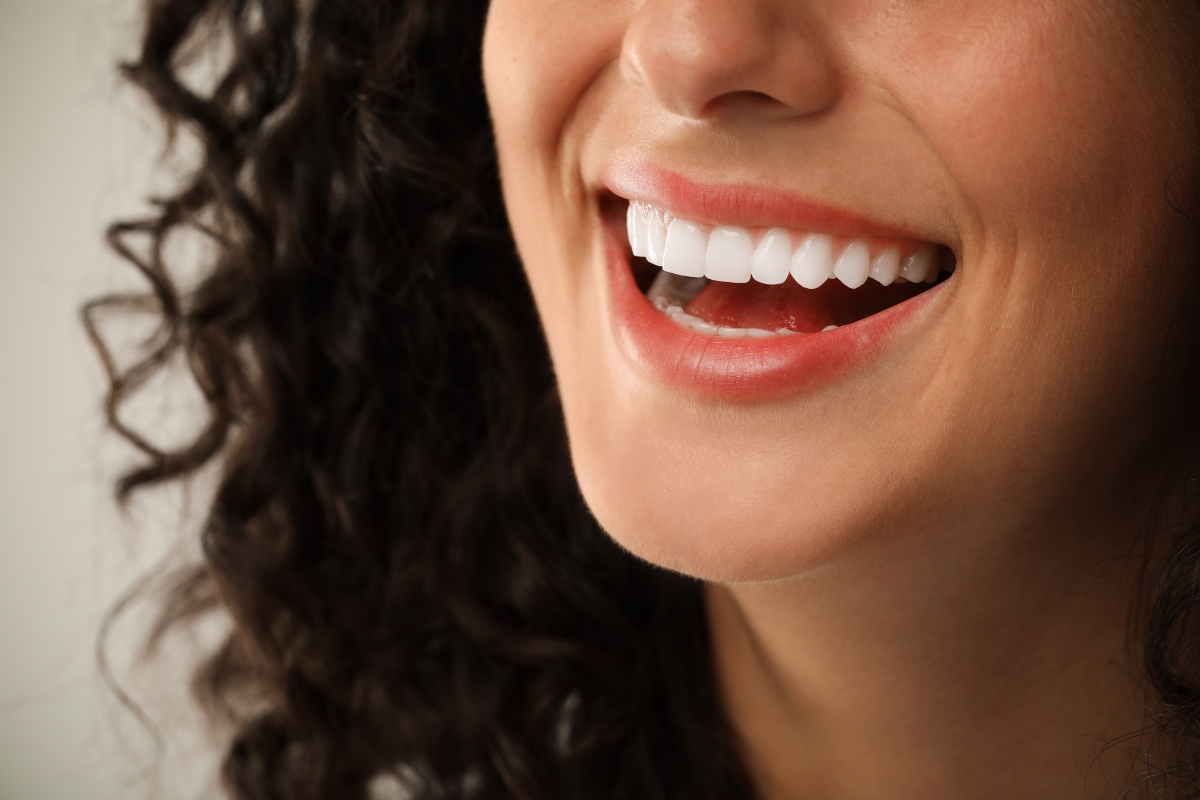 cosmetic-veneers-in-Burbank