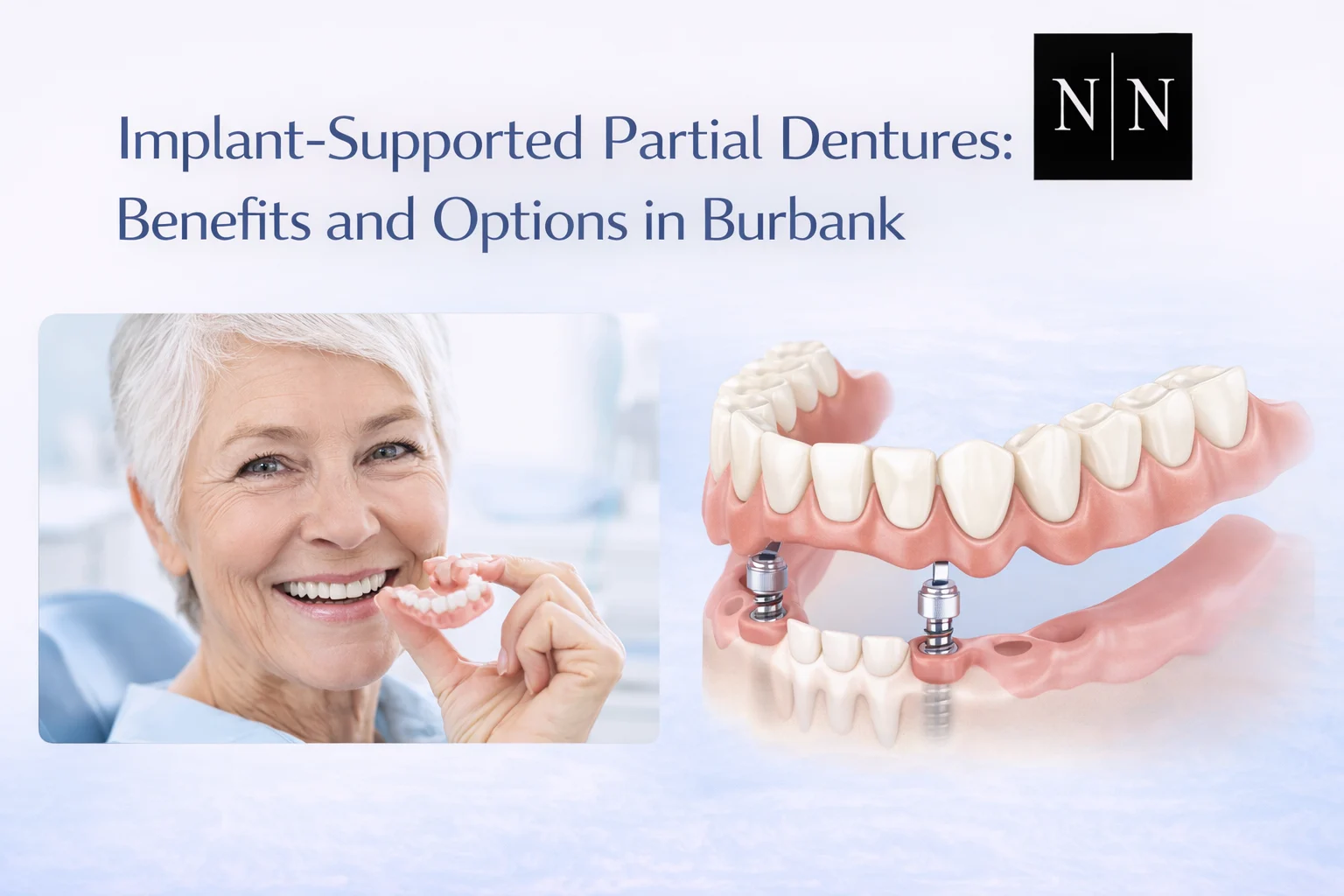 Implant-Supported Partial Dentures Benefits and Options in Burbank